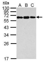 C4BPB Antibody in Western Blot (WB)