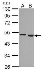 FDXR Antibody in Western Blot (WB)