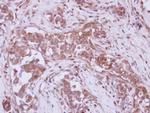 P2X7 Antibody in Immunohistochemistry (Paraffin) (IHC (P))