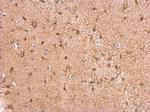 GPBB Antibody in Immunohistochemistry (Paraffin) (IHC (P))