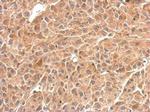 GPBB Antibody in Immunohistochemistry (Paraffin) (IHC (P))