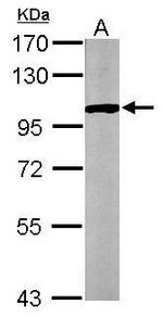 GPBB Antibody in Western Blot (WB)