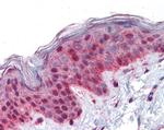 PLK1 Antibody in Immunohistochemistry (Paraffin) (IHC (P))