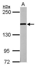 GLI3 Antibody in Western Blot (WB)