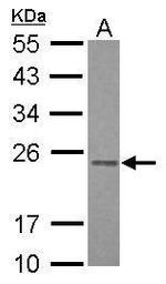 RAB3B Antibody in Western Blot (WB)