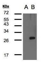 LYPLA1 Antibody in Western Blot (WB)