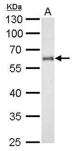 CYP1B1 Antibody in Western Blot (WB)