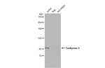 Tankyrase 2 Antibody in Western Blot (WB)