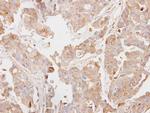 PCK2 Antibody in Immunohistochemistry (Paraffin) (IHC (P))