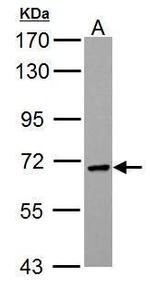 PCK2 Antibody in Western Blot (WB)