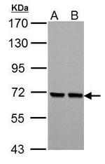 PCK2 Antibody in Western Blot (WB)