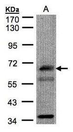 CHFR Antibody in Western Blot (WB)