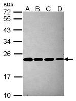 PSMB5 Antibody in Western Blot (WB)