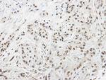 SPHK1 Antibody in Immunohistochemistry (Paraffin) (IHC (P))