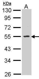 SPHK1 Antibody in Western Blot (WB)