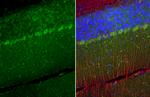 TRPC6 Antibody in Immunohistochemistry (Paraffin) (IHC (P))