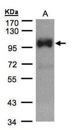 TRPC6 Antibody in Western Blot (WB)