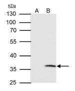 VDAC2 Antibody in Immunoprecipitation (IP)