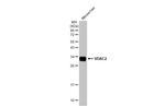 VDAC2 Antibody in Western Blot (WB)