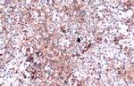 PD-L1 Antibody in Immunohistochemistry (Paraffin) (IHC (P))