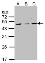 CYP7B1 Antibody in Western Blot (WB)