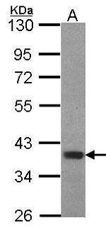 FOXB1 Antibody in Western Blot (WB)