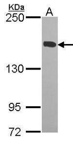 KIF4A Antibody in Western Blot (WB)