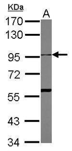 ADAM10 Antibody in Western Blot (WB)