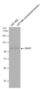 alpha Dystroglycan Antibody in Western Blot (WB)