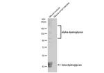 alpha Dystroglycan Antibody in Western Blot (WB)