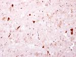 BTD Antibody in Immunohistochemistry (Paraffin) (IHC (P))