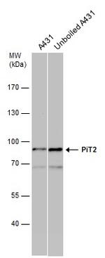 SLC20A2 Antibody in Western Blot (WB)