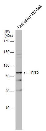 SLC20A2 Antibody in Western Blot (WB)