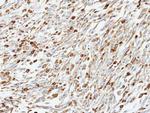 CALCOCO1 Antibody in Immunohistochemistry (Paraffin) (IHC (P))