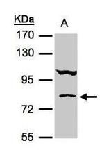 CALCOCO1 Antibody in Western Blot (WB)