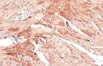 OGDH Antibody in Immunohistochemistry (Paraffin) (IHC (P))