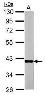 OTC Antibody in Western Blot (WB)