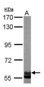 TCP-1 zeta Antibody in Western Blot (WB)