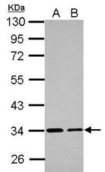 ETFA Antibody in Western Blot (WB)