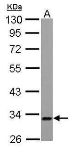 ETFA Antibody in Western Blot (WB)