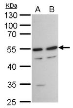 TAF7 Antibody in Western Blot (WB)