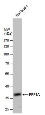 PP1 alpha Antibody in Western Blot (WB)