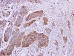 NDUFS1 Antibody in Immunohistochemistry (Paraffin) (IHC (P))