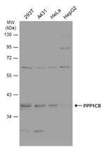 PP1 beta Antibody in Western Blot (WB)