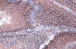 PP1 beta Antibody in Immunohistochemistry (Paraffin) (IHC (P))