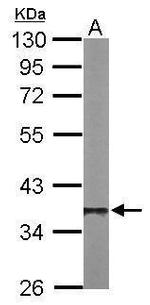 PP1 beta Antibody in Western Blot (WB)