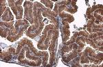 ACVR2B Antibody in Immunohistochemistry (Paraffin) (IHC (P))