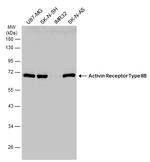 ACVR2B Antibody in Western Blot (WB)