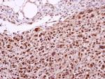 XPD Antibody in Immunohistochemistry (Paraffin) (IHC (P))