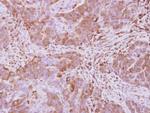 Optineurin Antibody in Immunohistochemistry (Paraffin) (IHC (P))